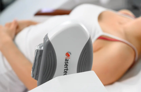 Коррекция рубцовых тканей (растяжки, атрофические рубцы)