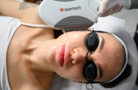 Коррекция эстетических сосудистых патологий