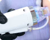 Растяжки, сколотые рубцы, дряблость кожи