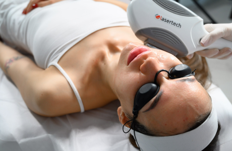 Коррекция акне