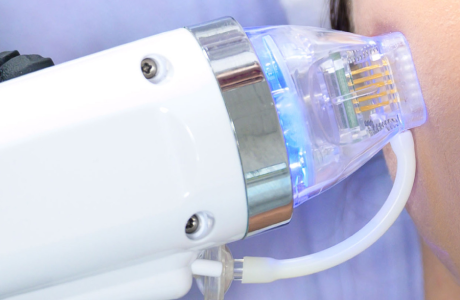 Растяжки, сколотые рубцы, дряблость кожи