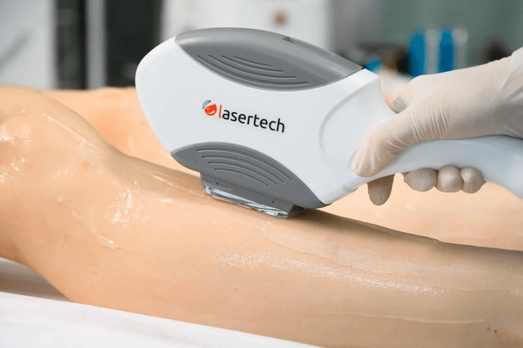 Lasertech Alfa с технологией ELOS